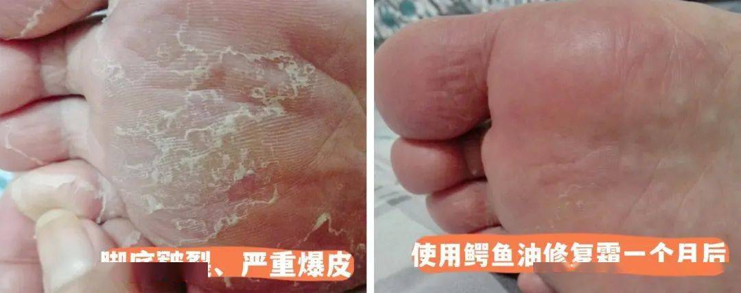 植物空瓶好物No.1！万能抗“燥”鳄鱼霜，从头到脚都能抹，堪比换皮！秋冬必备！