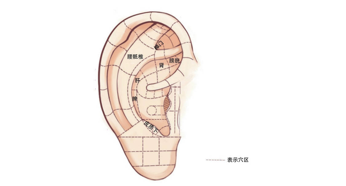 1,腰骶椎区及其周围常可见红色片状或紫红色斑点,红色表示新伤,瘀血未