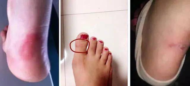 脚背 连续霸榜几年的马丁靴也该退位了吧！？这双保暖又软萌的乐福毛毛鞋才是今冬新秀！