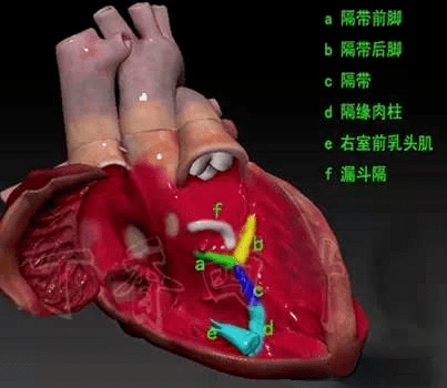 心脏解剖3d图谱~_分法_肉柱_漏斗