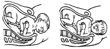 胎生过程简笔画图片