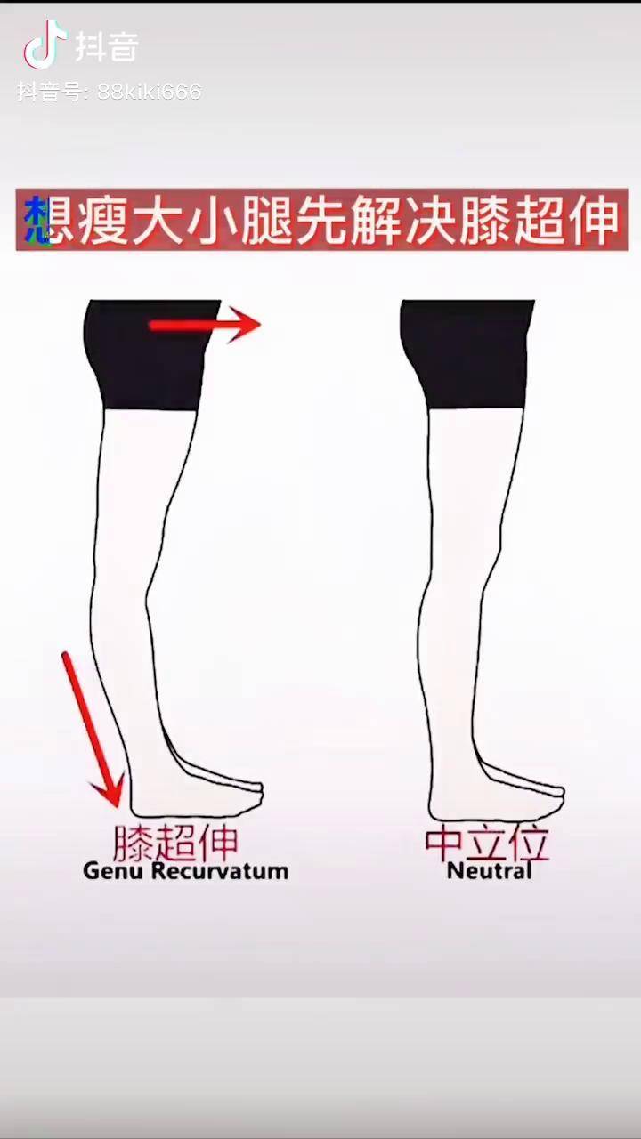 想瘦大小腿先解决膝超伸问题三个视频连起来看哦爆瘦大小腿