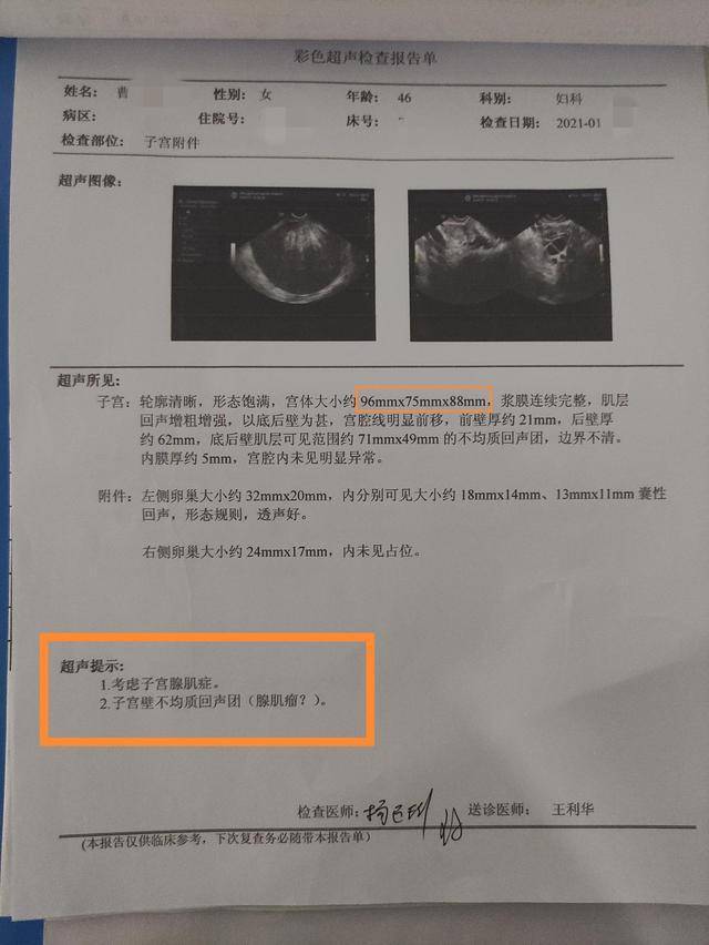 子宫肌瘤照片图b超图片