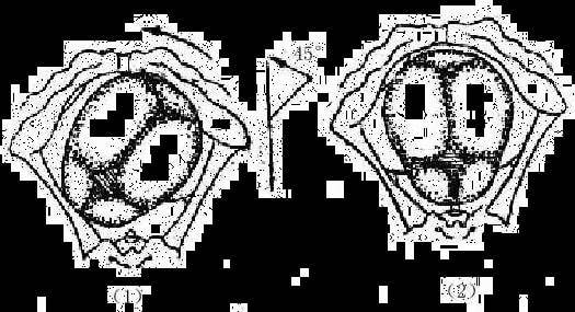 内旋转 胎头围绕骨盆纵轴前旋转,使其矢状缝与中骨盆及骨盆出口