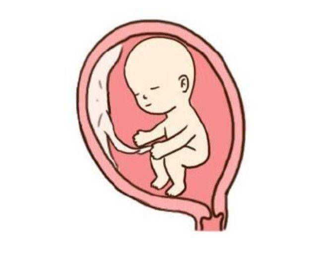 怀孕两个月胎儿位置图图片