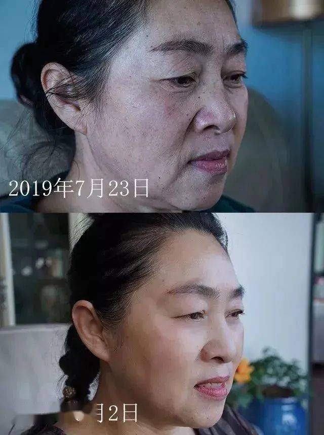 全网曾被花心男狠踹,42岁再婚生2胎胖到全网群嘲,如今暴瘦逆袭被老公宠到生活难自理:这段位,绝了!