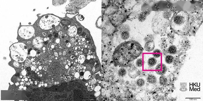 细胞|港大医学院揭示电子显微镜下奥密克戎变体“庐山真面目”