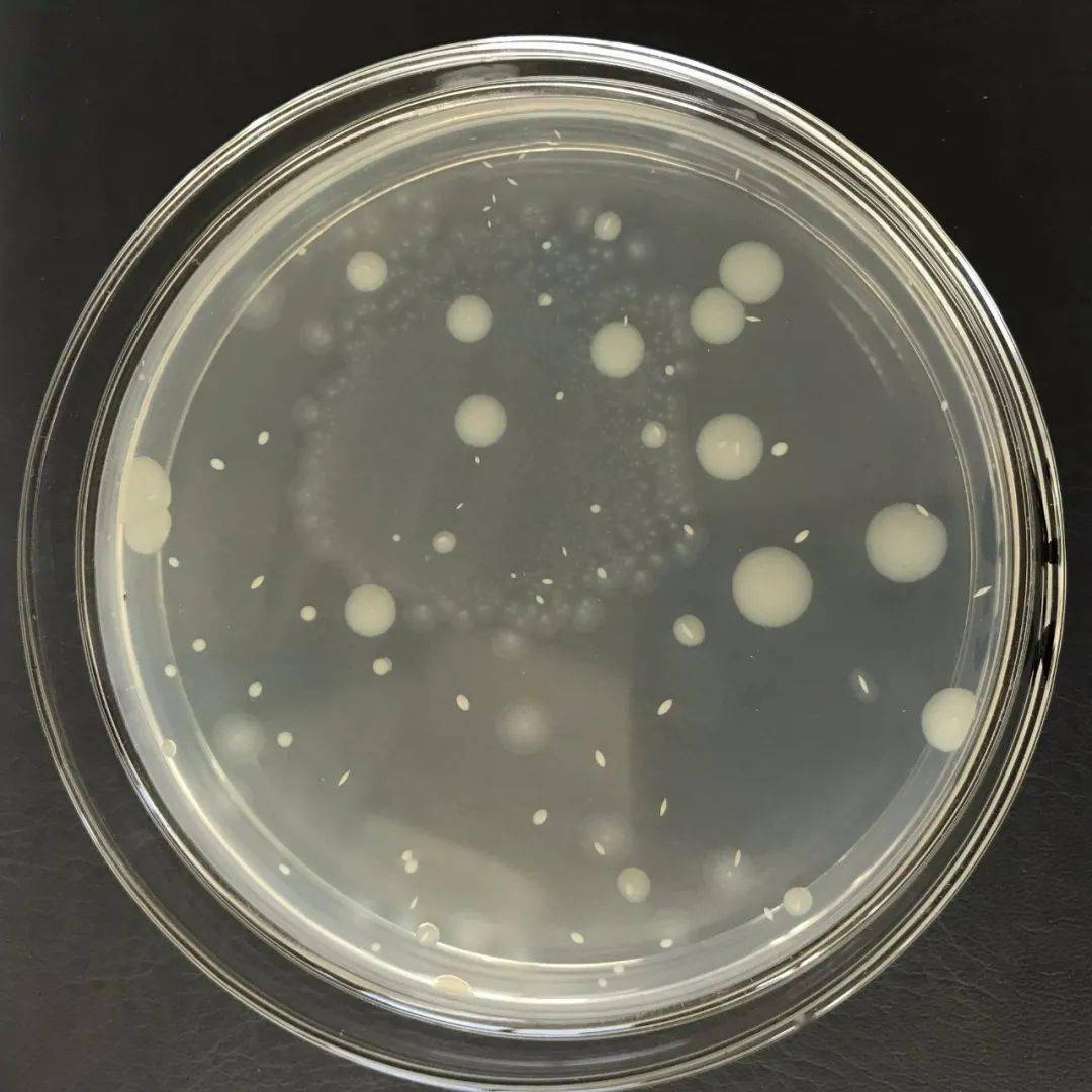 快自查菌落总数的错误操作你中招了没