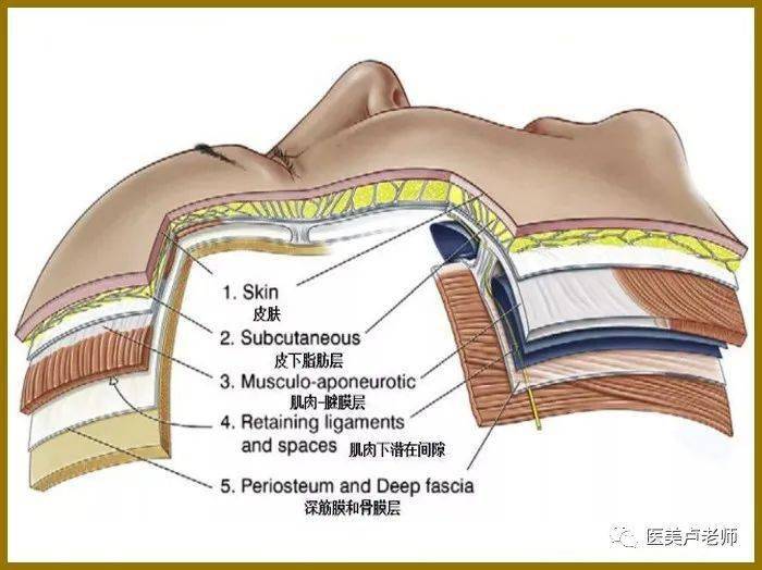 面部老化是面部骨骼,韧带,肌肉,脂肪组织和皮肤发生变化和相互作用的