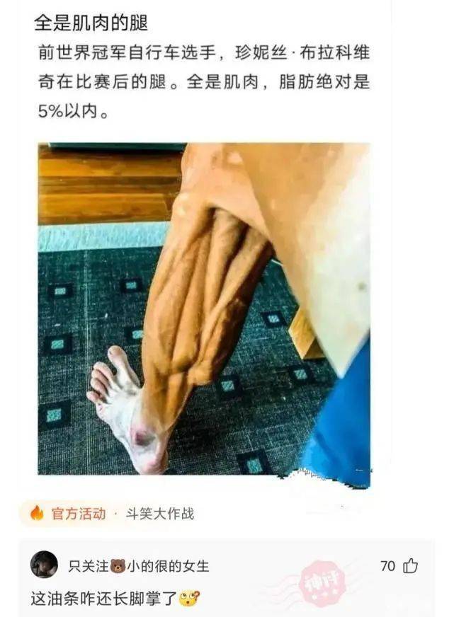 前世界冠军自行车选手,珍妮丝·布拉科维奇在比赛后的腿.