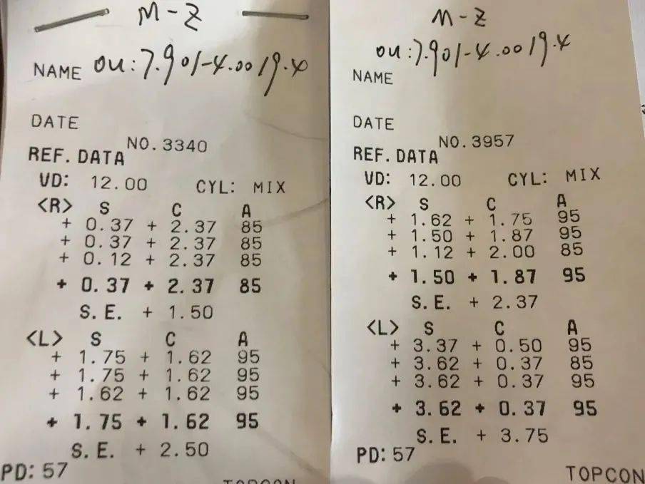 低度近视高度散光掌握这3点验配度数更准确