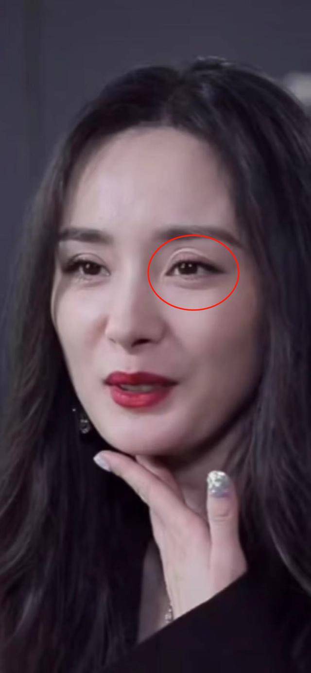 杨幂的眼睛怎么了?
