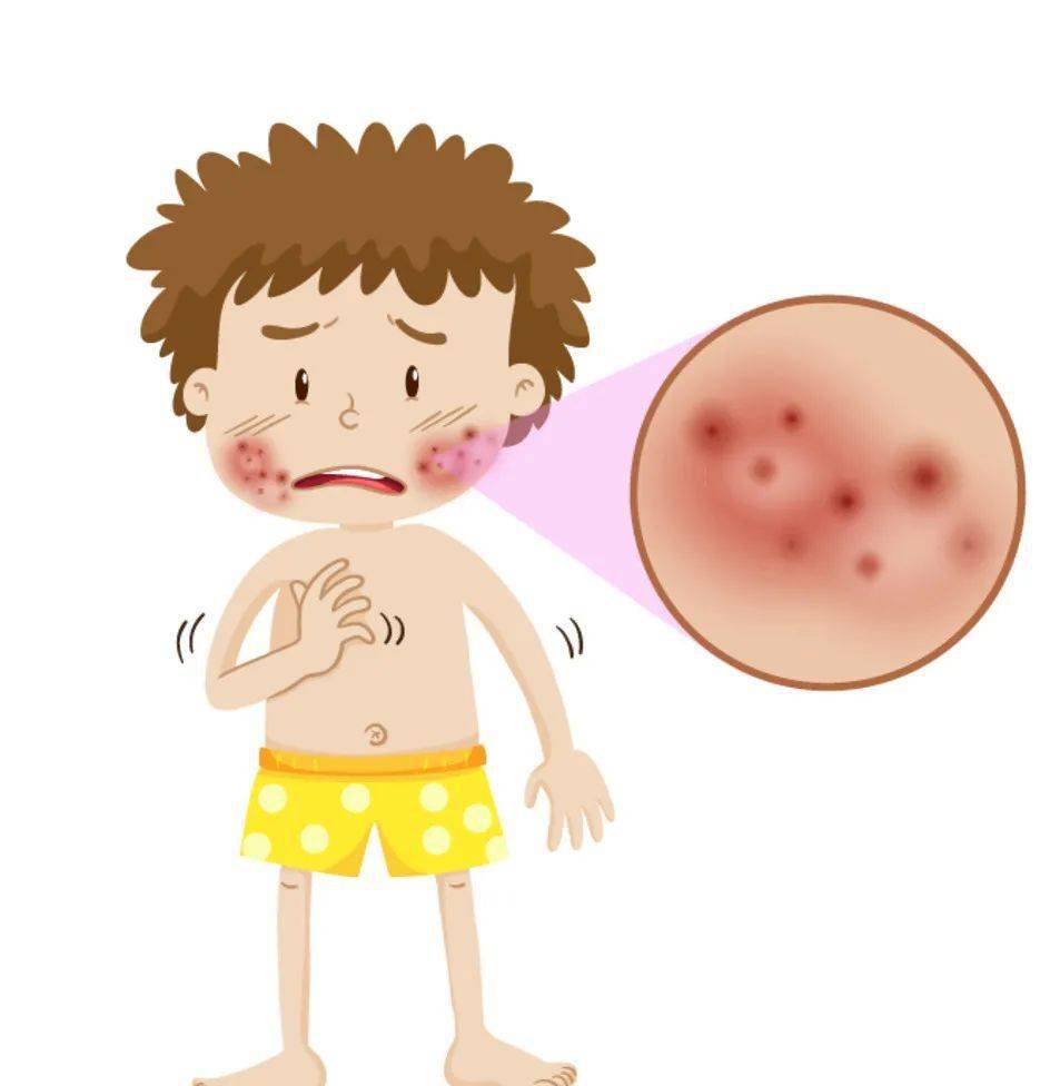 别让乏脂性湿疹找上门