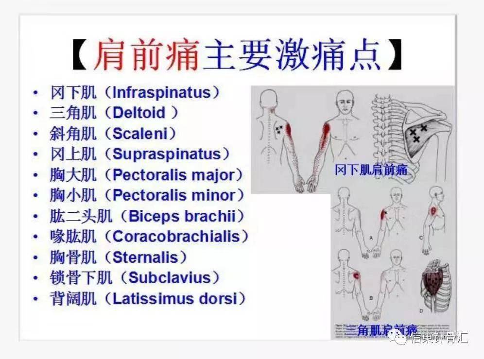 肌筋膜全身160个疼痛触发点