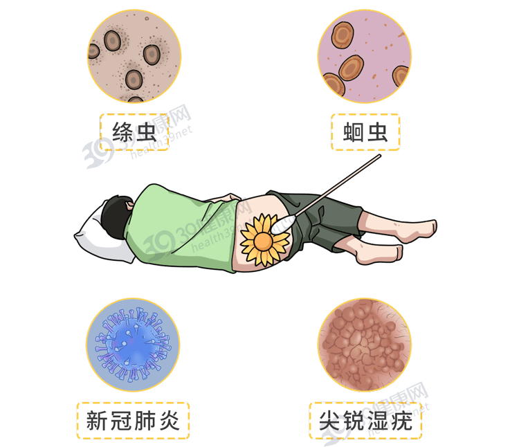 筛查各类肠道疾病也可以通过肛门做肠镜检查细菌,病毒,寄生虫等感染