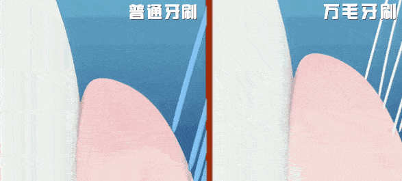 牙缝里|「牙齿橡皮擦」?一刷香口、黄渍消，二刷牙齿白如雪！