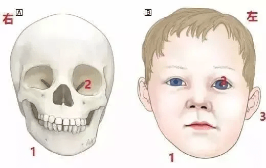 宝宝几个月开始出现地包天 9c1f8794424a4c02a69de8b43d9e1e49.png