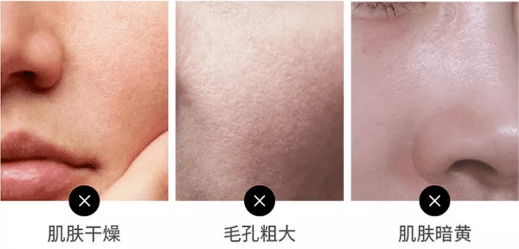 蜂胶你要在年末聚会上悄悄惊艳所有人！