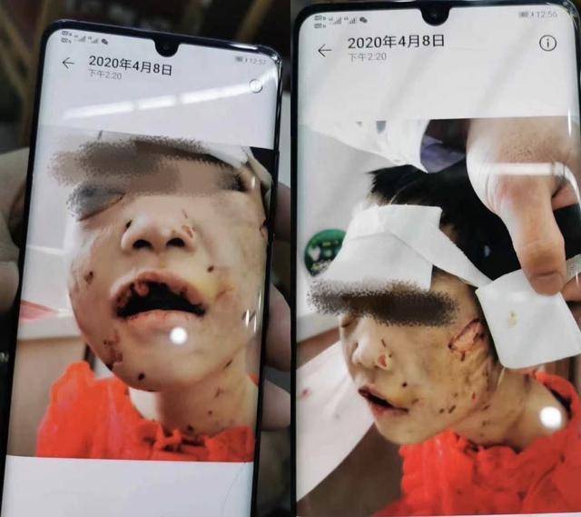 4岁女童惨遭家暴致颅内出血:孩子被家暴影响怎么办?