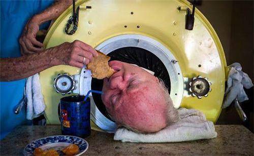 美国最后一位铁肺人,在"铁桶"里生活69年,一生惧怕暴雨停电_病人_保罗