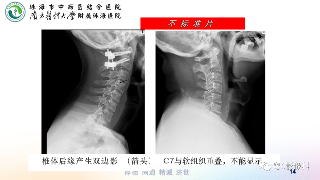 dr检查正常图片图片