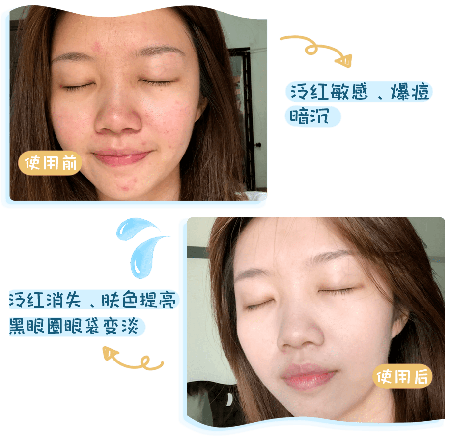 屏障为什么她敷出了从美容院出来的效果？
