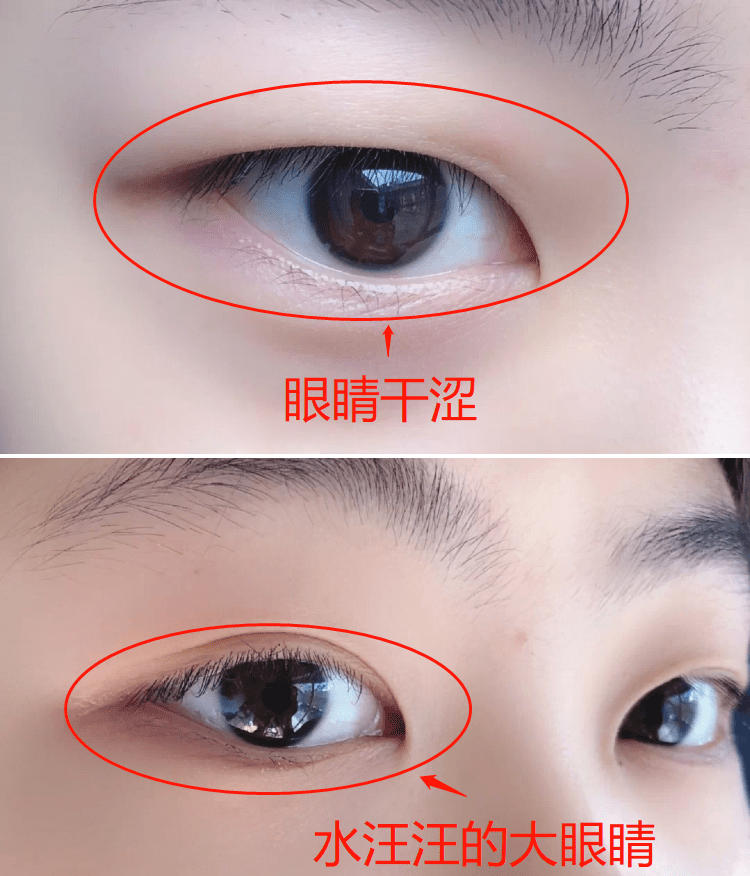 眼睛眼睛的“回春药”找到了，睡前戴它，25分钟蒸走干涩 、黑眼圈，还你明眸！
