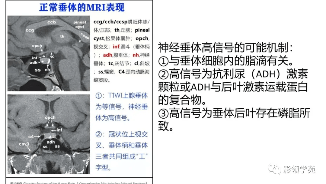 Rathke|垂体解剖及常见病变影像学表现