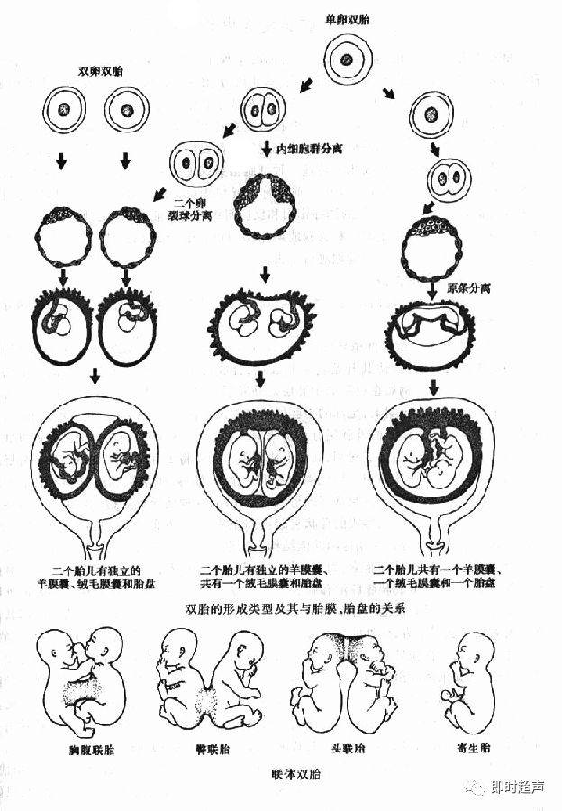 前庭球肿大的症状图片