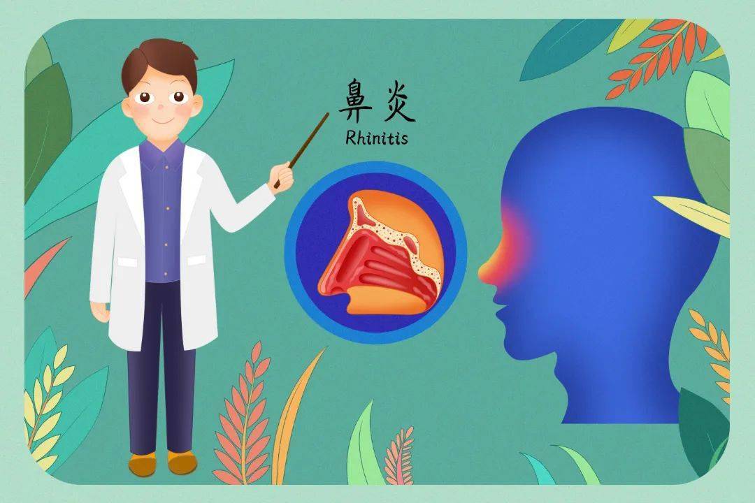 鼻竇沖洗的禁忌症:急性發熱,中耳炎,鼻出血,鼻息肉,鼻前庭炎,鼻前庭癤