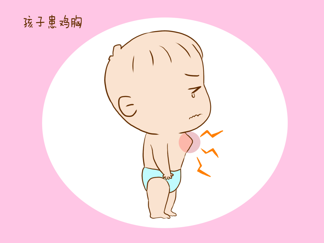 鸡胸，不是饭桌上的肉，而是一种小儿常见疾病