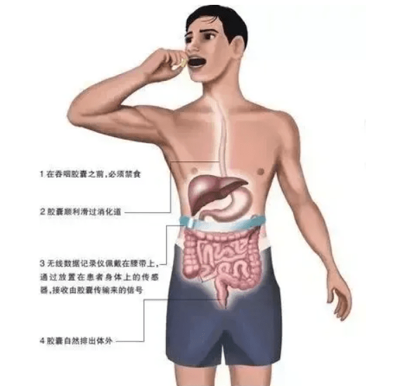 附属|邵阳学院附属第一医院即将开展胶囊内镜检查