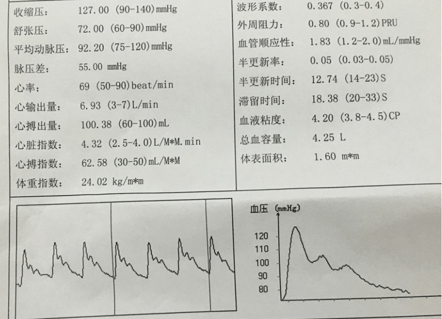 影响“我，不节食，3个月瘦身30斤”：方法比努力更重要！