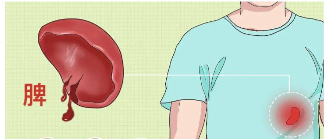 那些与脾切除有关的事_脾脏_免疫_淋巴