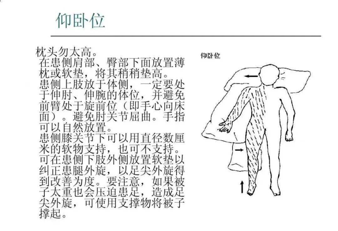 肩痛,肩手综合征,骨盆后倾,髋关节外展,外旋以及早期诱发分离运动等均