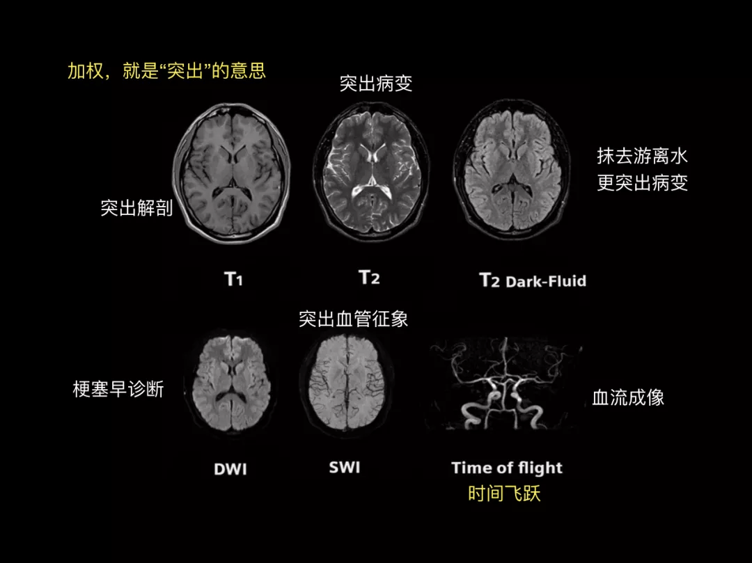 头颅冠状位矢状位图解图片