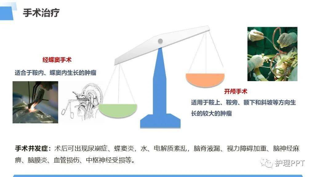 垂体瘤患者护理查房