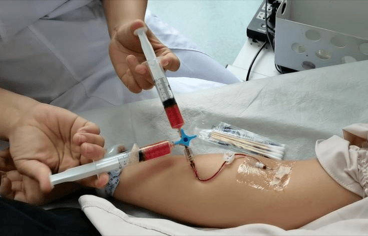 与生理盐水充分混合后经肘静脉推注,分别在平静呼吸及valsalva动作后