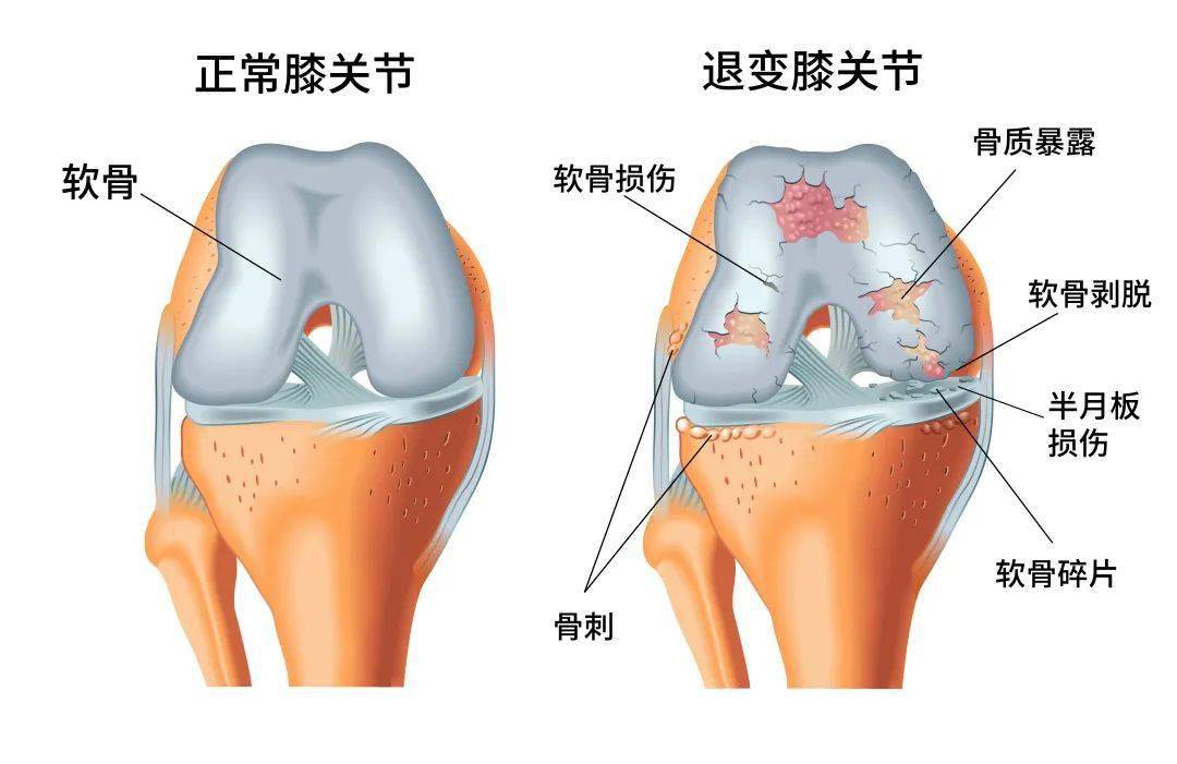 膝关节