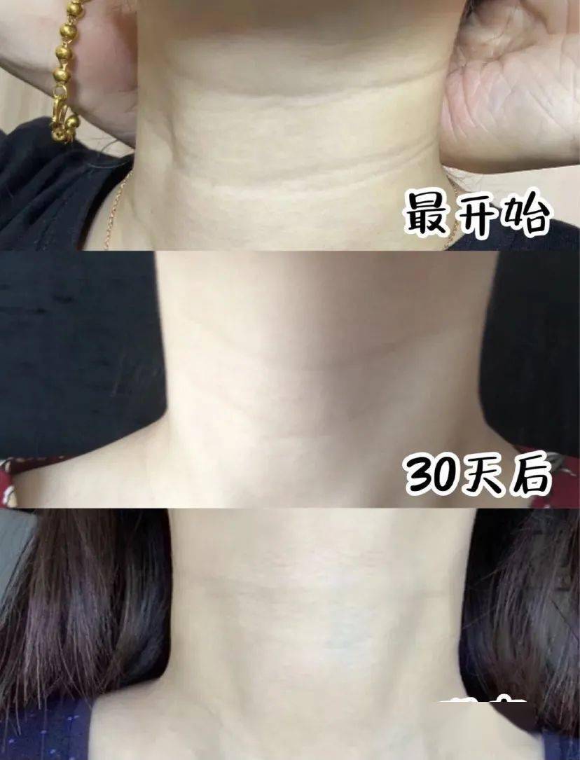 国货“显老”颈纹真的能“滚”掉!!430年的国货,一招get女明星“天鹅颈”!