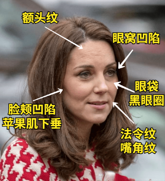 无辜为啥生娃5年的奶茶妹妹比热巴还嫩？
