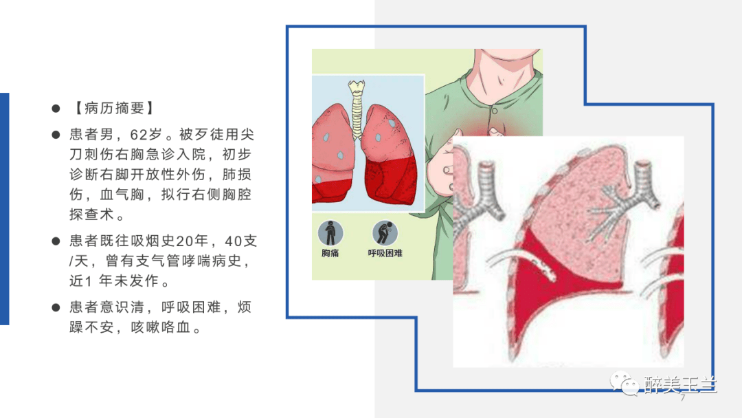 087abad359764a6eac5002bfdf81d6d9.png