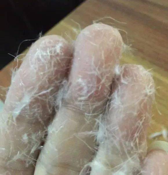 一条假羽绒被带来的危害让人触目惊心