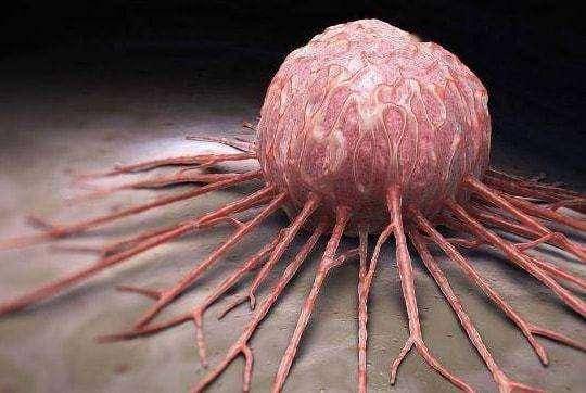 女性宫颈出现病变腿部可能会发出预警不妨留心观察下