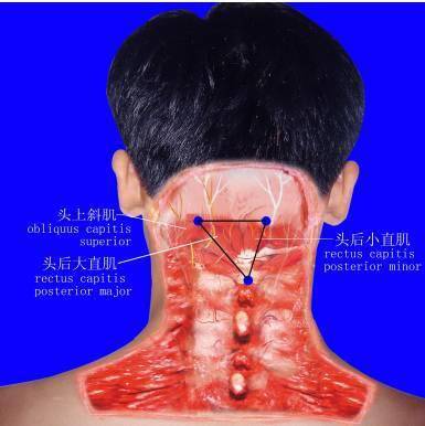 颈部上段深层肌肉主要有椎枕肌构成软组织立体三角区,其应力点位于