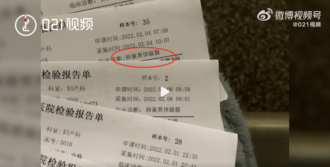 确诊为卵巢黄体破裂!经过b超检查后马上去了医院!