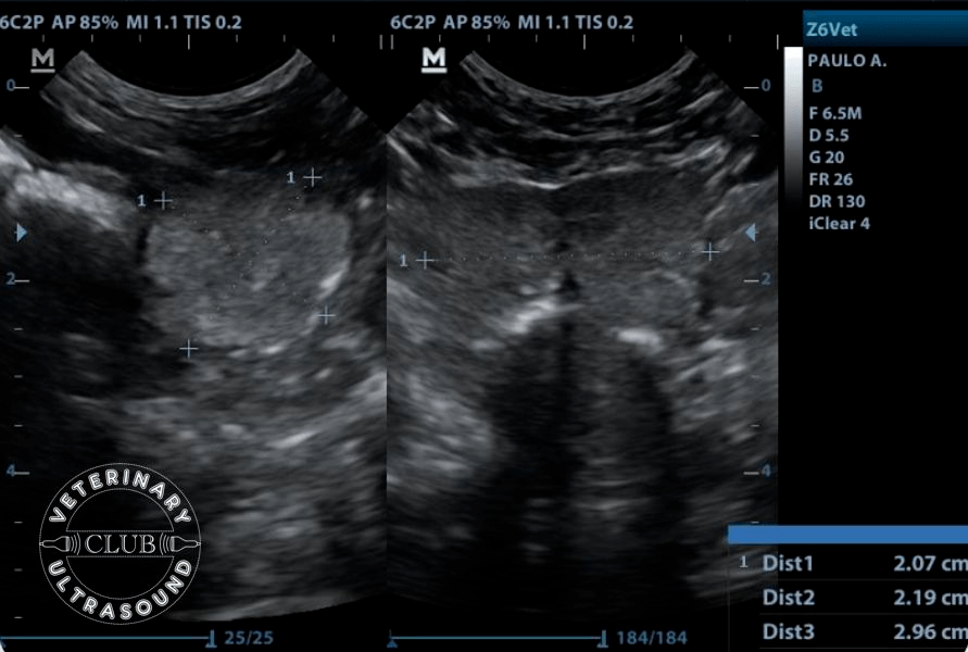 孕33周男宝睾丸b超图图片
