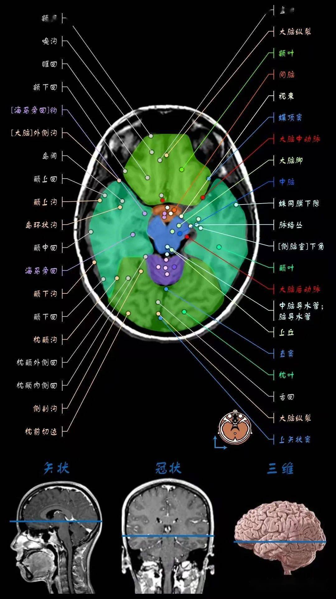 顱腦mri超詳細三維標註(最新版)_全網_影像_解剖圖