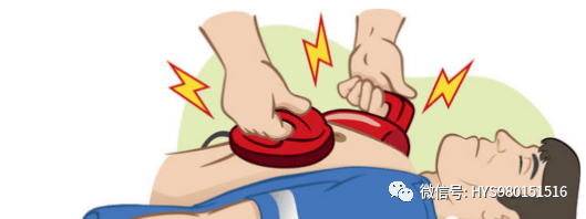 ▎5.不支持双重连续除颤