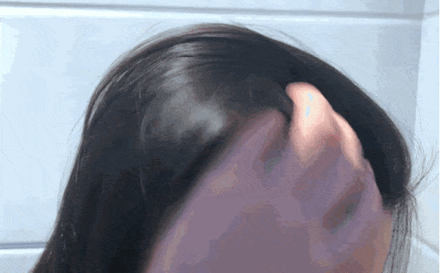 因为散着头发睡觉更健康？99%的女生都做错了，难怪头发油腻还脱发！
